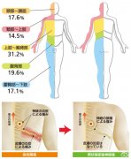 帶狀皰疹癥狀表現(xiàn)是什么樣的？